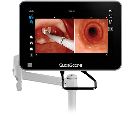 Medical endoscopy monitor showing a magnified view of a throat and an airway.