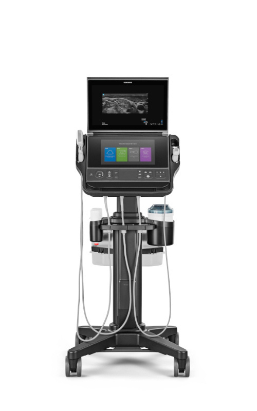 An ultrasound machine on a rolling stand with a high-resolution display monitor.
